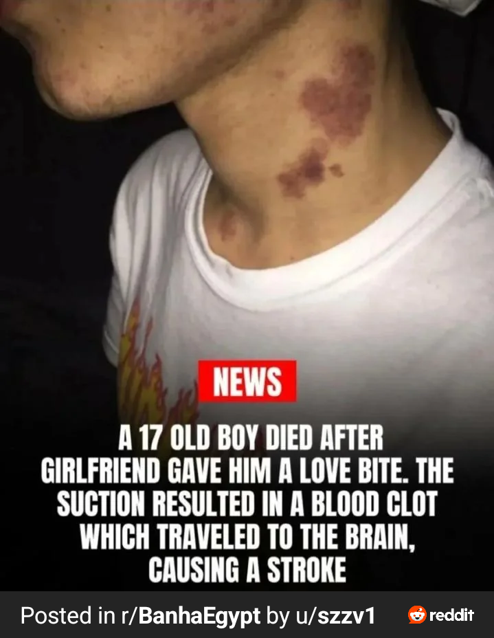 Open love bite stroke